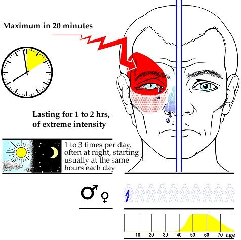 drawing of headache intensity